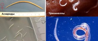 Roundworms (nematodes)
